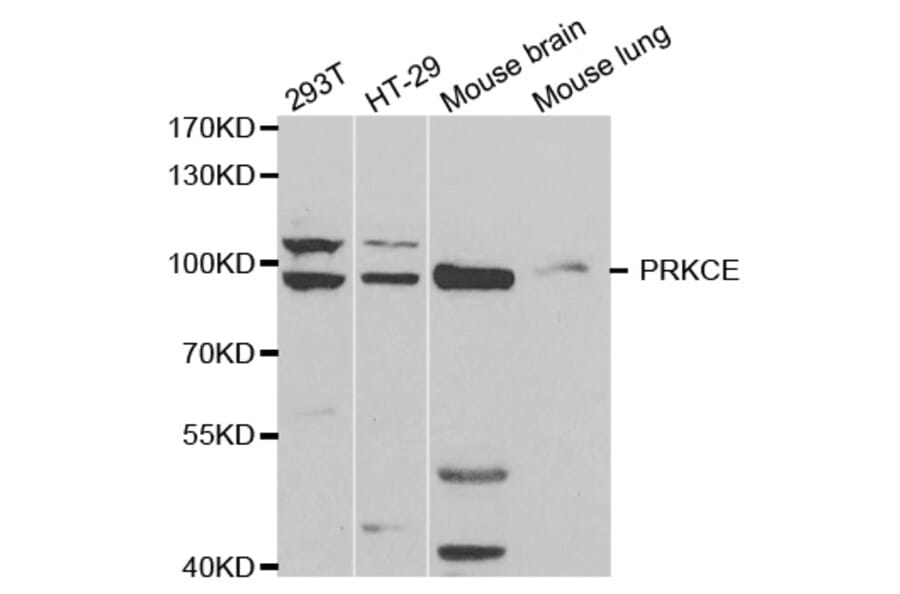 Western blot - PRKCE Antibody from Signalway Antibody (32603) - Antibodies.com