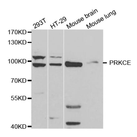 Western blot - PRKCE Antibody from Signalway Antibody (32603) - Antibodies.com