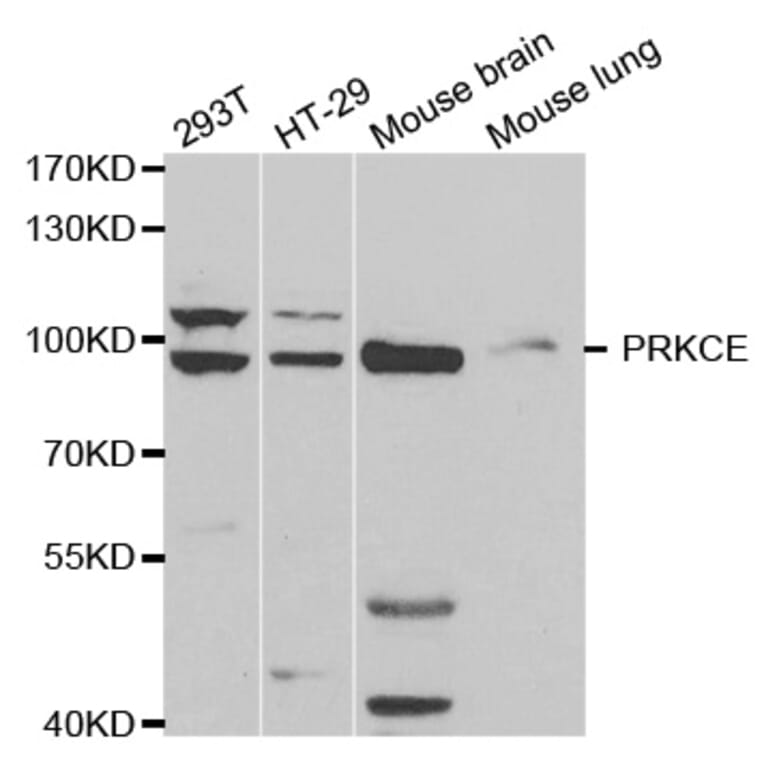 Western blot - PRKCE Antibody from Signalway Antibody (32603) - Antibodies.com