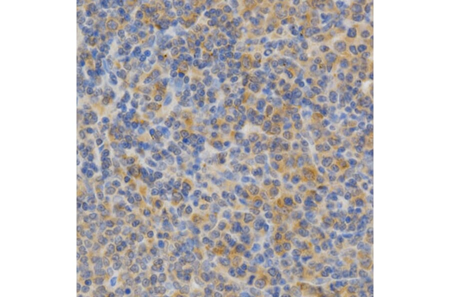 Immunohistochemistry - PRKCE Antibody from Signalway Antibody (32603) - Antibodies.com
