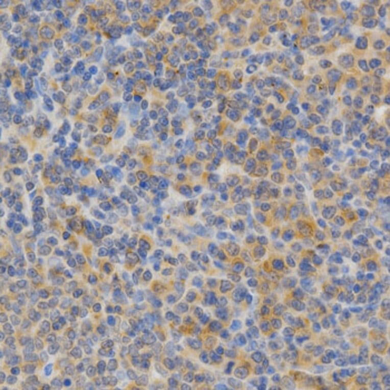 Immunohistochemistry - PRKCE Antibody from Signalway Antibody (32603) - Antibodies.com