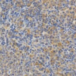 Immunohistochemistry - PRKCE Antibody from Signalway Antibody (32603) - Antibodies.com
