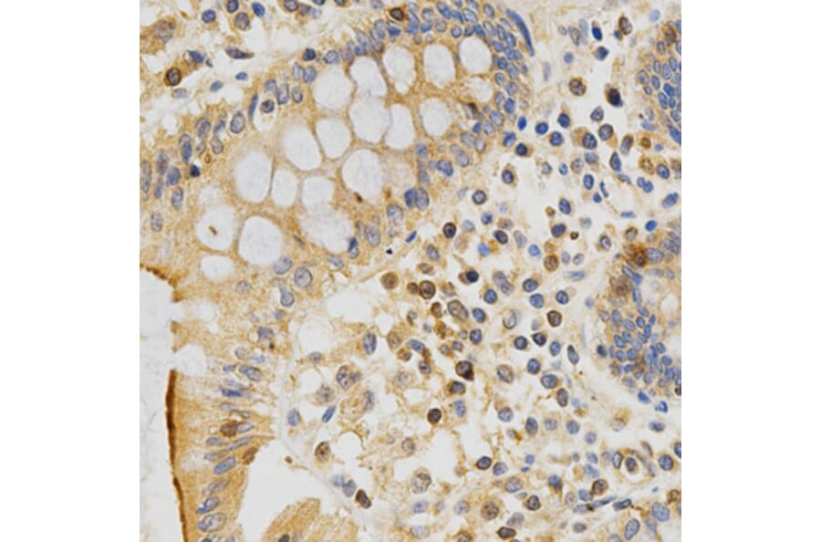 Immunohistochemistry - PRKCE Antibody from Signalway Antibody (32603) - Antibodies.com