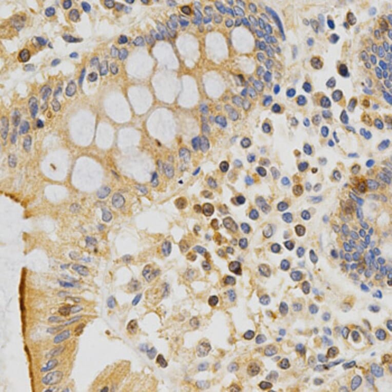 Immunohistochemistry - PRKCE Antibody from Signalway Antibody (32603) - Antibodies.com