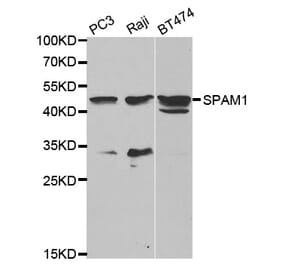 Western blot - SPAM1 Antibody from Signalway Antibody (32610) - Antibodies.com