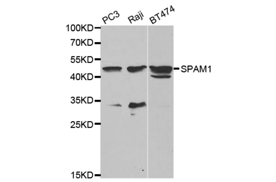 Western blot - SPAM1 Antibody from Signalway Antibody (32610) - Antibodies.com