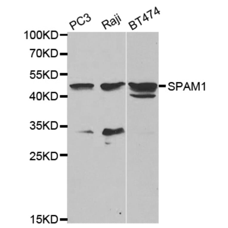Western blot - SPAM1 Antibody from Signalway Antibody (32610) - Antibodies.com