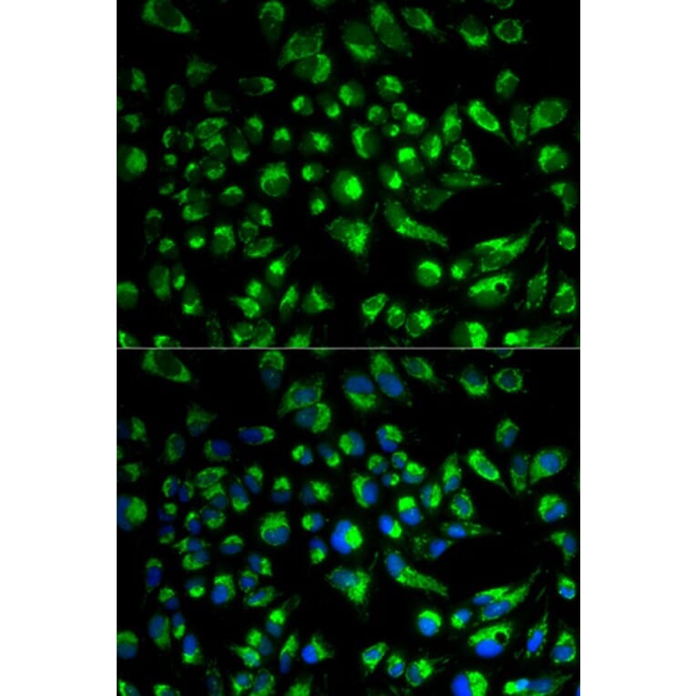 Immunofluorescence - SPAM1 Antibody from Signalway Antibody (32610) - Antibodies.com