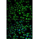Immunofluorescence - SPAM1 Antibody from Signalway Antibody (32610) - Antibodies.com