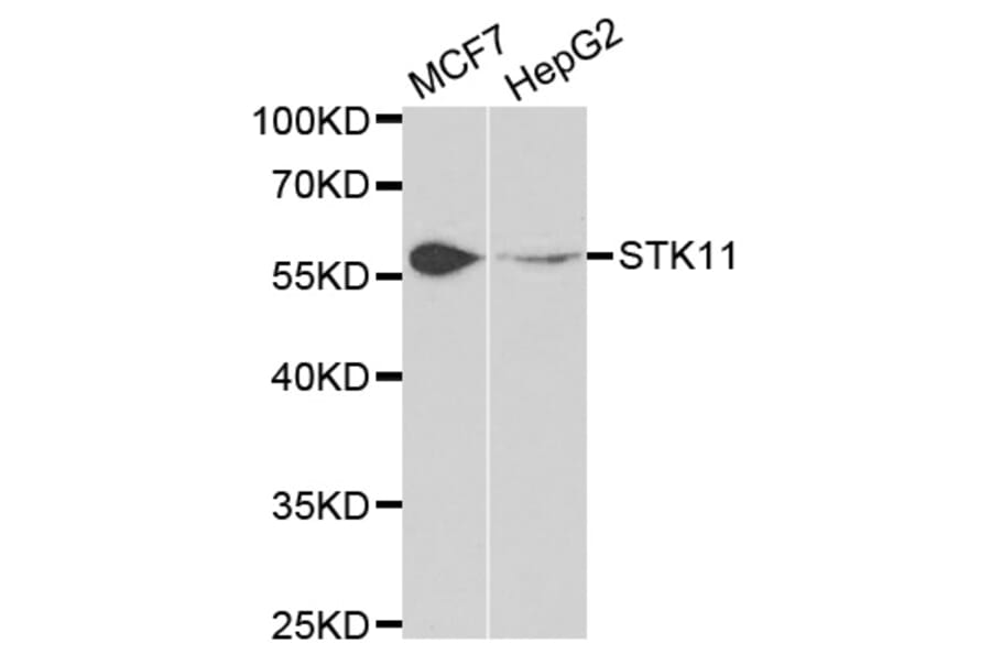 Western blot - STK11 Antibody from Signalway Antibody (32612) - Antibodies.com