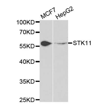 Western blot - STK11 Antibody from Signalway Antibody (32612) - Antibodies.com