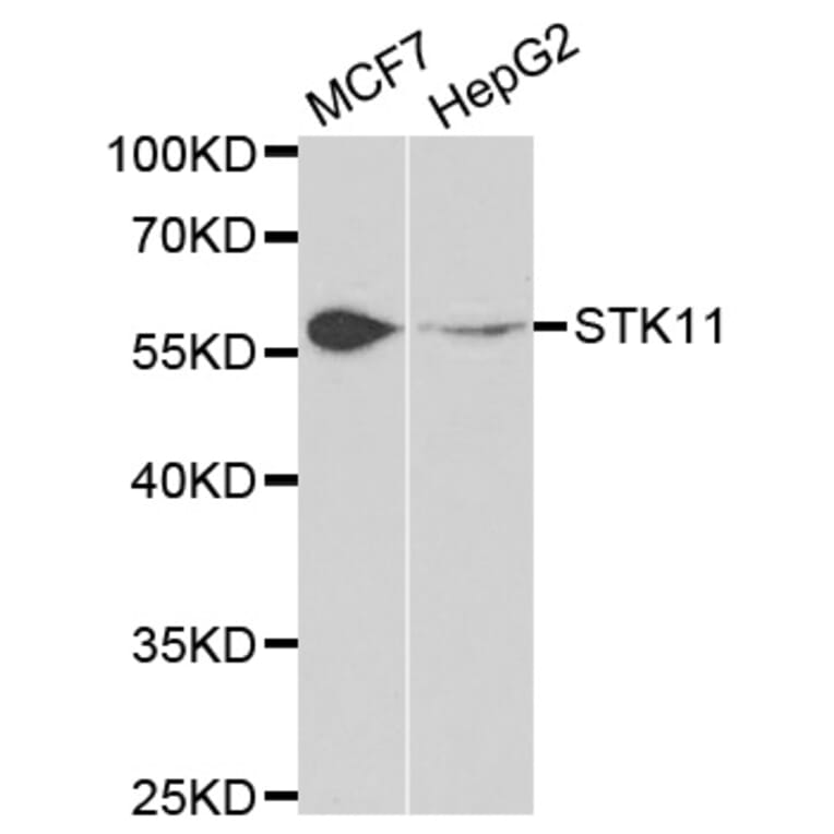 Western blot - STK11 Antibody from Signalway Antibody (32612) - Antibodies.com