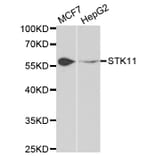 Western blot - STK11 Antibody from Signalway Antibody (32612) - Antibodies.com