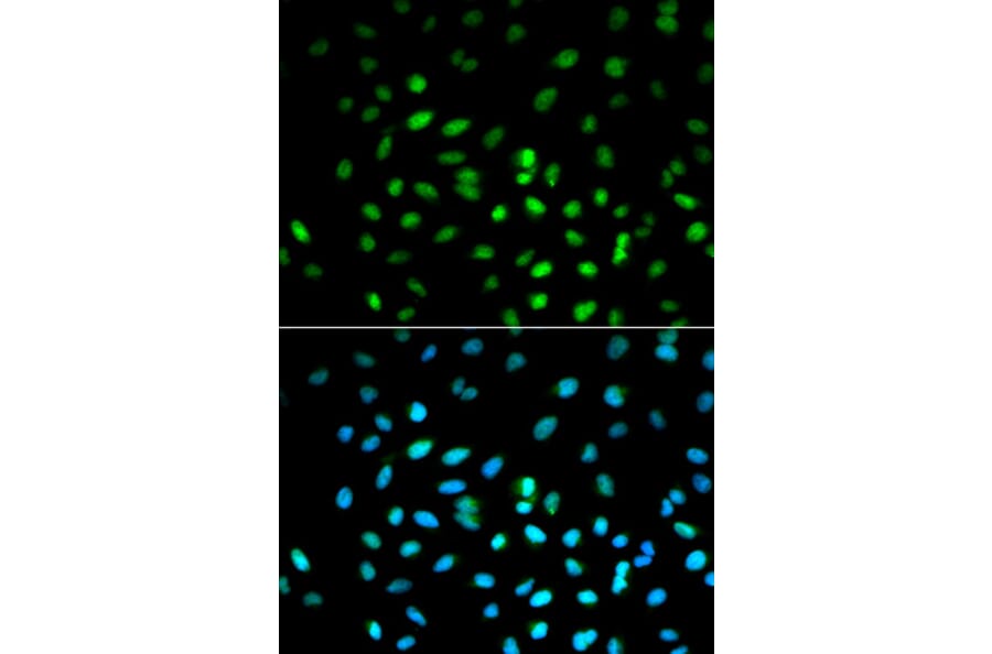Immunofluorescence - STK11 Antibody from Signalway Antibody (32612) - Antibodies.com