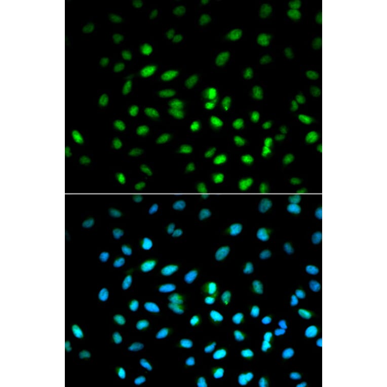 Immunofluorescence - STK11 Antibody from Signalway Antibody (32612) - Antibodies.com