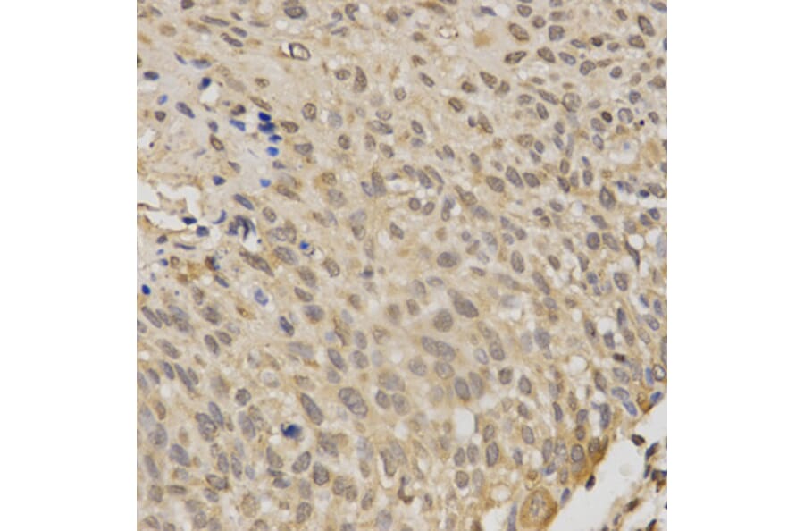 Immunohistochemistry - STK11 Antibody from Signalway Antibody (32612) - Antibodies.com