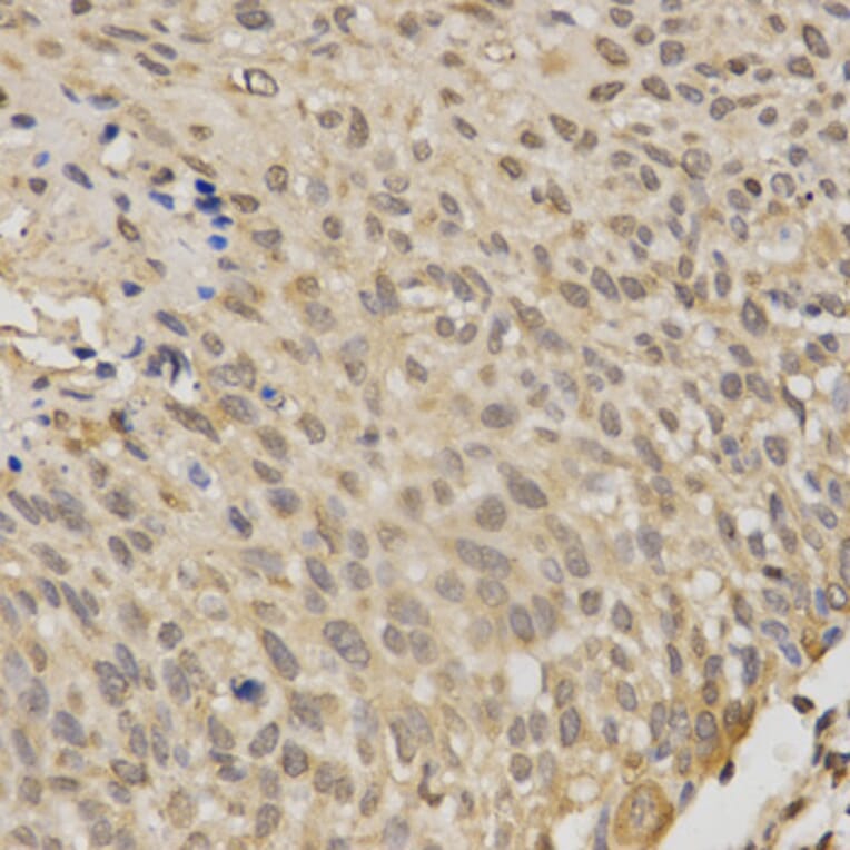 Immunohistochemistry - STK11 Antibody from Signalway Antibody (32612) - Antibodies.com