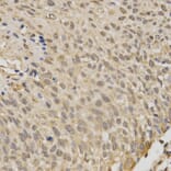 Immunohistochemistry - STK11 Antibody from Signalway Antibody (32612) - Antibodies.com