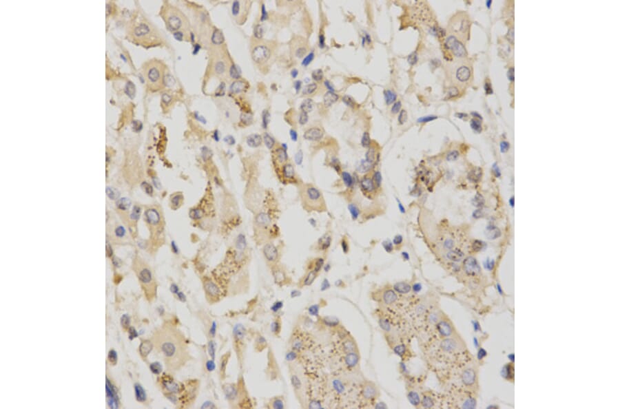 Immunohistochemistry - STK11 Antibody from Signalway Antibody (32612) - Antibodies.com