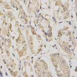 Immunohistochemistry - STK11 Antibody from Signalway Antibody (32612) - Antibodies.com