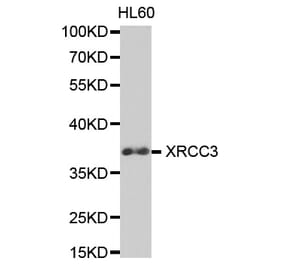 Western blot - XRCC3 Antibody from Signalway Antibody (32617) - Antibodies.com