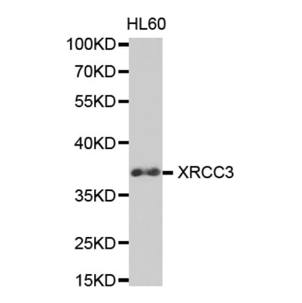 Western blot - XRCC3 Antibody from Signalway Antibody (32617) - Antibodies.com