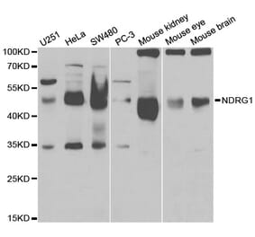 Western blot - NDRG1 Antibody from Signalway Antibody (32622) - Antibodies.com