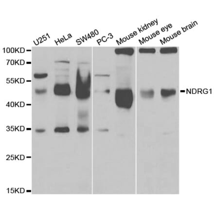 Western blot - NDRG1 Antibody from Signalway Antibody (32622) - Antibodies.com