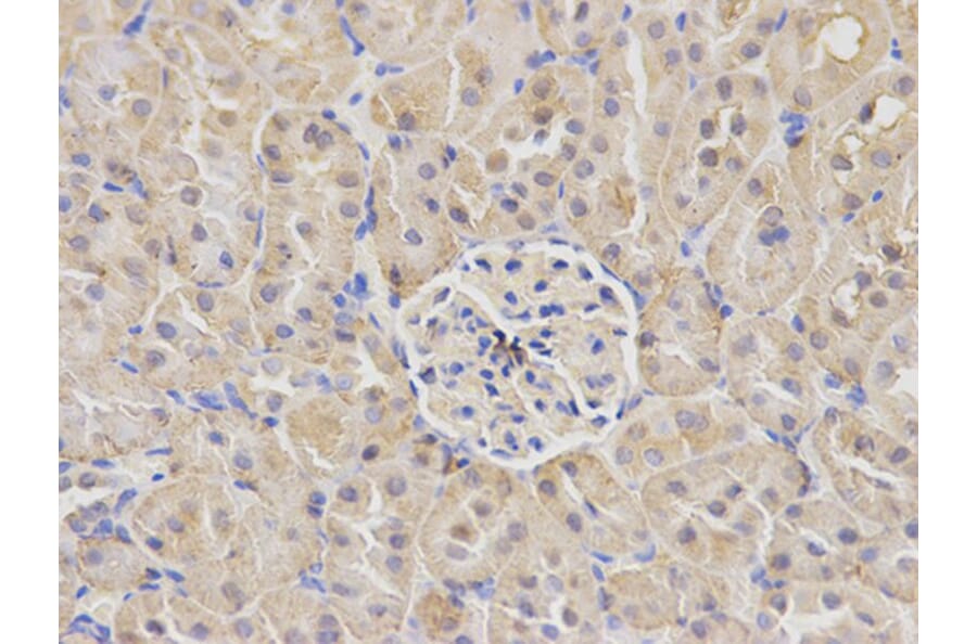 Immunohistochemistry - NDRG1 Antibody from Signalway Antibody (32622) - Antibodies.com