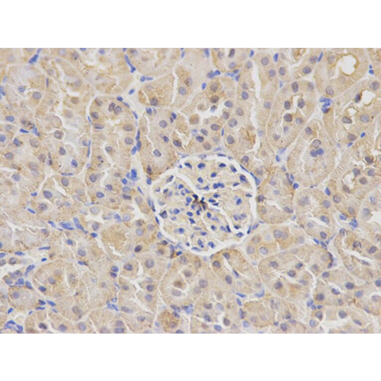 Immunohistochemistry - NDRG1 Antibody from Signalway Antibody (32622) - Antibodies.com