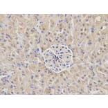 Immunohistochemistry - NDRG1 Antibody from Signalway Antibody (32622) - Antibodies.com
