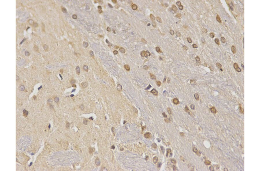 Immunohistochemistry - NDRG1 Antibody from Signalway Antibody (32622) - Antibodies.com