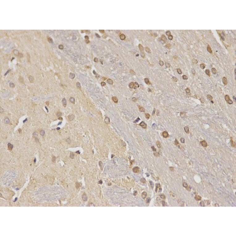 Immunohistochemistry - NDRG1 Antibody from Signalway Antibody (32622) - Antibodies.com