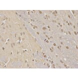 Immunohistochemistry - NDRG1 Antibody from Signalway Antibody (32622) - Antibodies.com