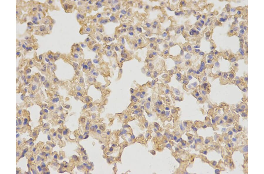 Immunohistochemistry - NDRG1 Antibody from Signalway Antibody (32622) - Antibodies.com