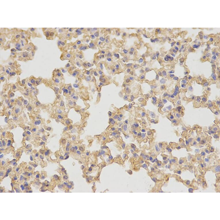 Immunohistochemistry - NDRG1 Antibody from Signalway Antibody (32622) - Antibodies.com