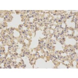 Immunohistochemistry - NDRG1 Antibody from Signalway Antibody (32622) - Antibodies.com