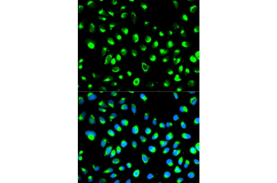 Immunofluorescence - NDRG1 Antibody from Signalway Antibody (32622) - Antibodies.com