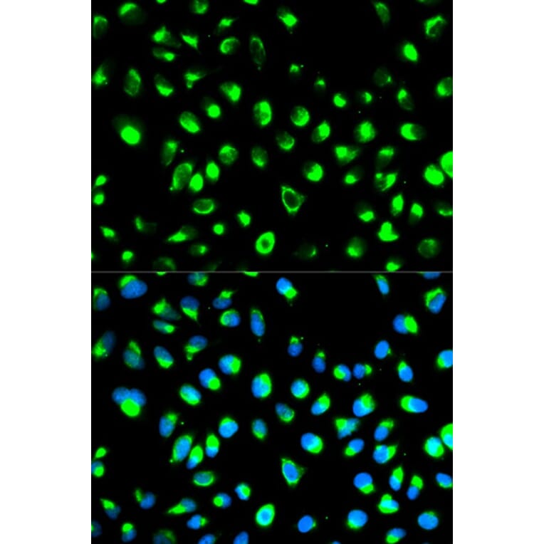 Immunofluorescence - NDRG1 Antibody from Signalway Antibody (32622) - Antibodies.com