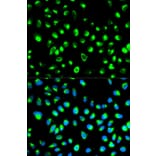 Immunofluorescence - NDRG1 Antibody from Signalway Antibody (32622) - Antibodies.com