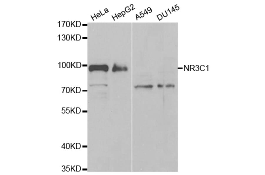 Western blot - NR3C1 Antibody from Signalway Antibody (32634) - Antibodies.com