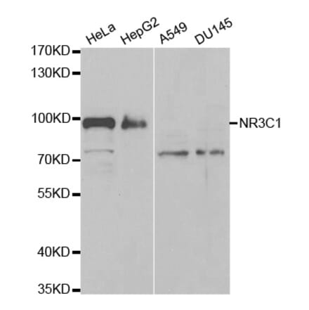 Western blot - NR3C1 Antibody from Signalway Antibody (32634) - Antibodies.com
