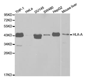 Western blot - HLA-A Antibody from Signalway Antibody (32636) - Antibodies.com