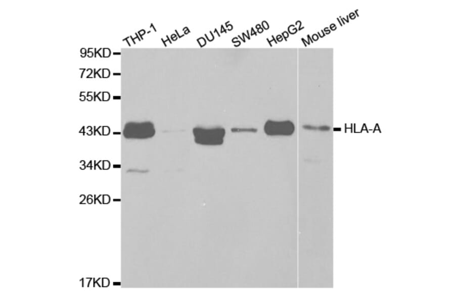 Western blot - HLA-A Antibody from Signalway Antibody (32636) - Antibodies.com