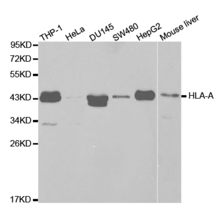 Western blot - HLA-A Antibody from Signalway Antibody (32636) - Antibodies.com