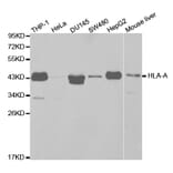 Western blot - HLA-A Antibody from Signalway Antibody (32636) - Antibodies.com