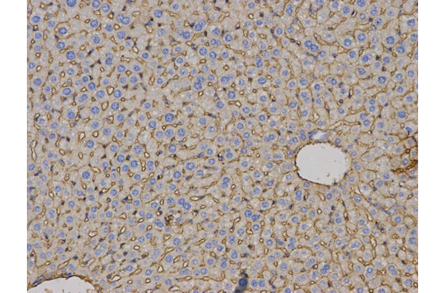 Immunohistochemistry - HLA-A Antibody from Signalway Antibody (32636) - Antibodies.com