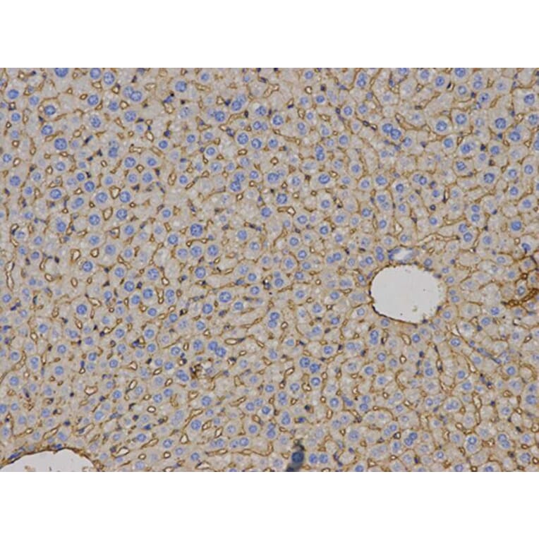 Immunohistochemistry - HLA-A Antibody from Signalway Antibody (32636) - Antibodies.com