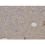 Immunohistochemistry - HLA-A Antibody from Signalway Antibody (32636) - Antibodies.com