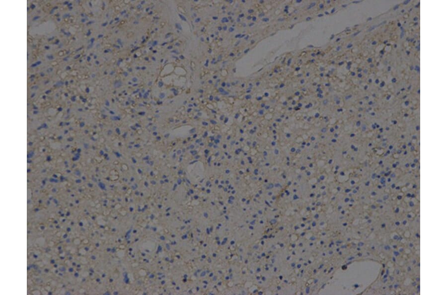 Immunohistochemistry - HLA-A Antibody from Signalway Antibody (32636) - Antibodies.com